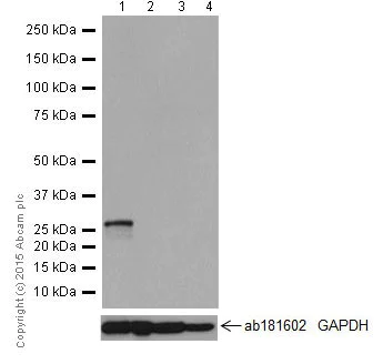 Western blot - Anti-KCNIP4 antibody [EPR18314] - BSA and Azide free (AB251403)
