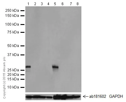 Western blot - Anti-KCNIP4 antibody [EPR18314] - BSA and Azide free (AB251403)