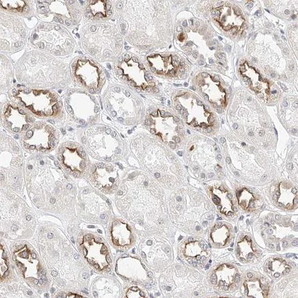 Immunohistochemistry (Formalin/PFA-fixed paraffin-embedded sections) - Anti-KCNJ1 antibody (AB224749)
