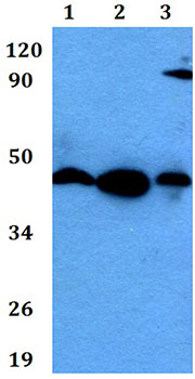 Western blot - Anti-KCNJ15 antibody (AB200642), expandable thumbnail