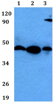 Western blot - Anti-KCNJ15 antibody (AB200642)
