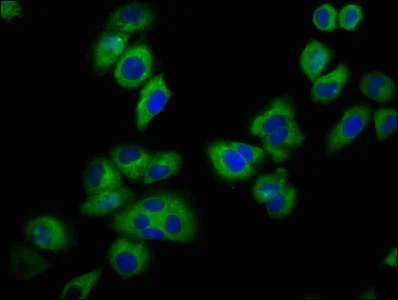 Immunocytochemistry/ Immunofluorescence - Anti-KCNJ5 antibody (AB236756)