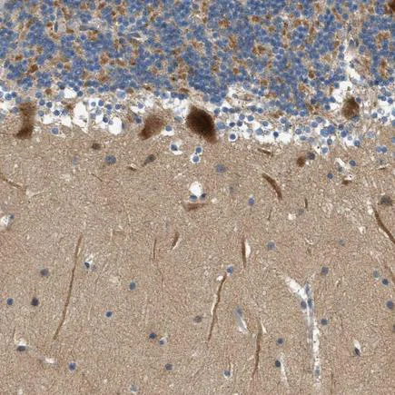 Immunohistochemistry (Formalin/PFA-fixed paraffin-embedded sections) - Anti-KCNK1/TWIK1 antibody (AB224381)