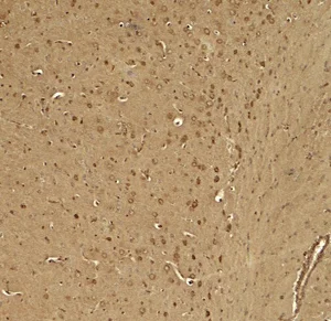 Immunohistochemistry (Formalin/PFA-fixed paraffin-embedded sections) - Anti-KCNK1/TWIK1 antibody - C-terminal (AB211299)