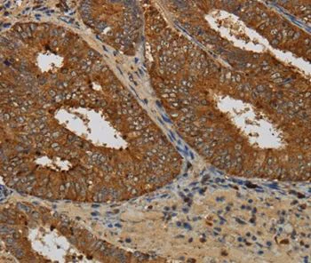 Immunohistochemistry (Formalin/PFA-fixed paraffin-embedded sections) - Anti-KCNK17 antibody - N-terminal (AB198043)