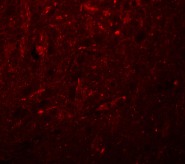 Immunocytochemistry/ Immunofluorescence - Anti-KCNK18/TRESK antibody (AB106411), expandable thumbnail