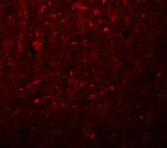 Immunocytochemistry/ Immunofluorescence - Anti-KCNK18/TRESK antibody (AB106411)