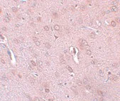 Immunohistochemistry (Formalin/PFA-fixed paraffin-embedded sections) - Anti-KCNK18/TRESK antibody (AB106411)
