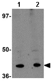 Western blot - Anti-KCNK18/TRESK antibody (AB106411)