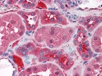 Immunohistochemistry (Formalin/PFA-fixed paraffin-embedded sections) - Anti-KCNN2/SK2 antibody (AB111939)