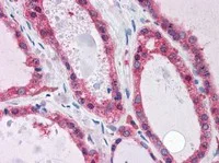Immunohistochemistry (Formalin/PFA-fixed paraffin-embedded sections) - Anti-KCNN2/SK2 antibody (AB111939)