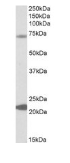 Western blot - Anti-KCNN2/SK2 antibody (AB99457)