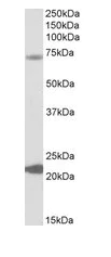 Western blot - Anti-KCNN2/SK2 antibody (AB99457)