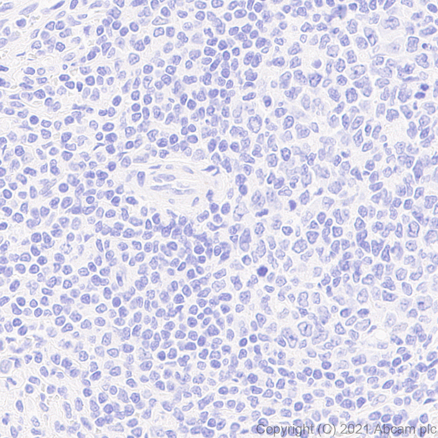 Immunohistochemistry (Formalin/PFA-fixed paraffin-embedded sections) - Anti-KCNN2/SK2 antibody [EPR25233-1] (AB288299)