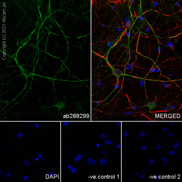 Immunocytochemistry/ Immunofluorescence - Anti-KCNN2/SK2 antibody [EPR25233-1] - BSA and Azide free (AB288309)