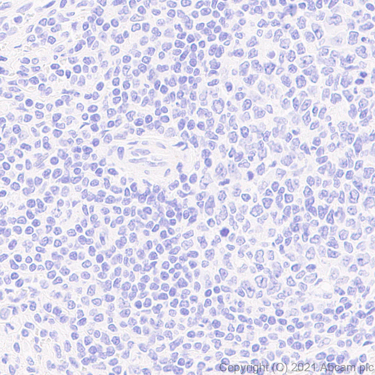 Immunohistochemistry (Formalin/PFA-fixed paraffin-embedded sections) - Anti-KCNN2/SK2 antibody [EPR25233-1] - BSA and Azide free (AB288309)