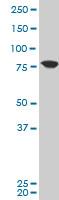 Western blot - Anti-KCNN3/SK3 antibody (AB194347), expandable thumbnail