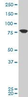 Western blot - Anti-KCNN3/SK3 antibody (AB194347)