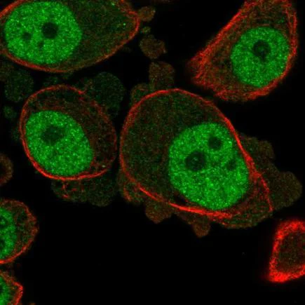 Immunocytochemistry/ Immunofluorescence - Anti-KCNN3/SK3 antibody (AB220864)