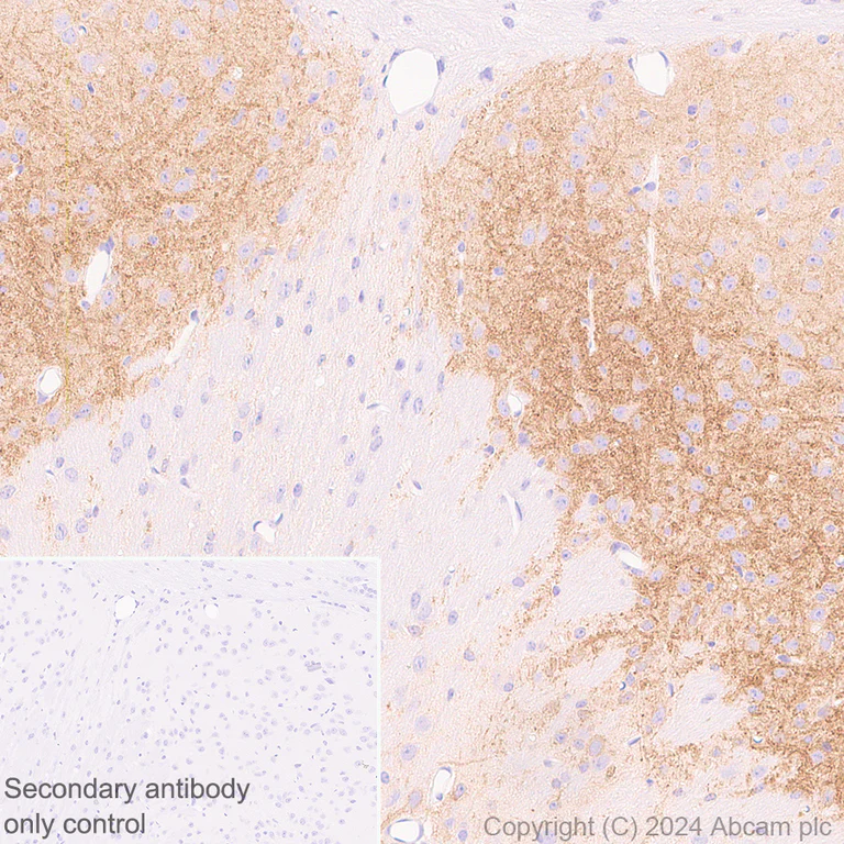 Immunohistochemistry (Formalin/PFA-fixed paraffin-embedded sections) - Anti-KCNN3/SK3 antibody [EPR28322-1] (AB317691)