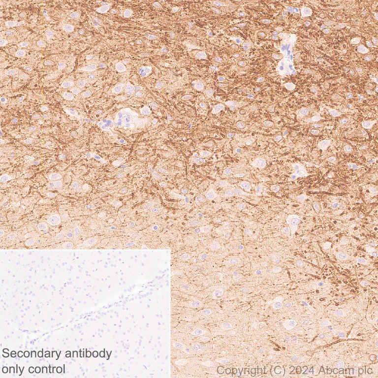 Immunohistochemistry (Formalin/PFA-fixed paraffin-embedded sections) - Anti-KCNN3/SK3 antibody [EPR28322-1] (AB317691)
