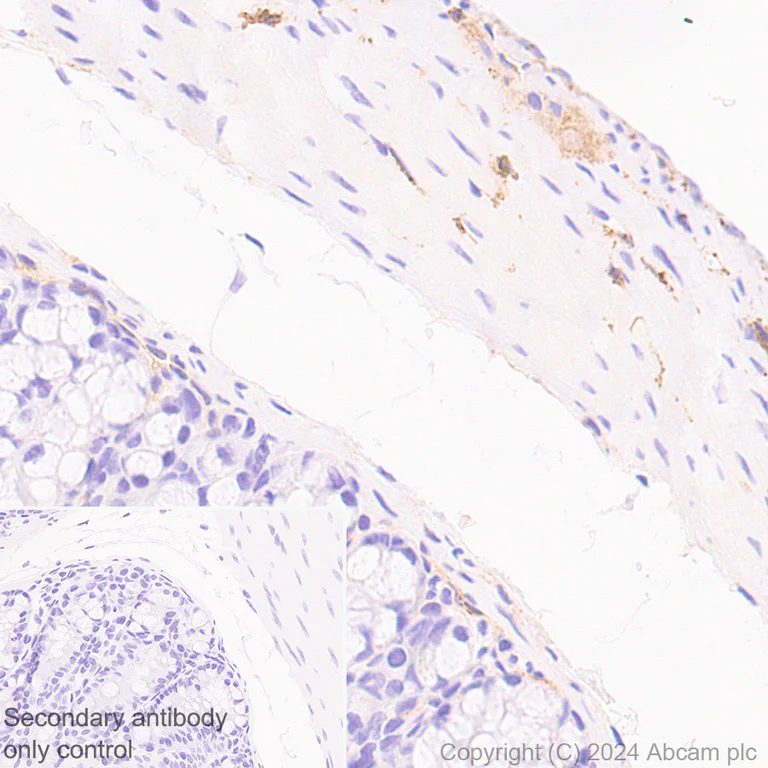 Immunohistochemistry (Formalin/PFA-fixed paraffin-embedded sections) - Anti-KCNN3/SK3 antibody [EPR28322-1] (AB317691)