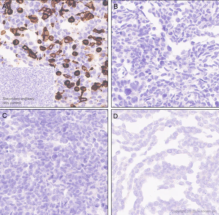 Immunohistochemistry (Formalin/PFA-fixed paraffin-embedded sections) - Anti-KCNN3/SK3 antibody [EPR28322-1] (AB317691)
