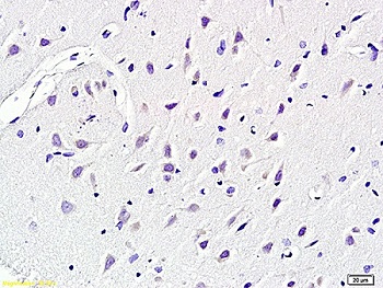 Immunohistochemistry (Formalin/PFA-fixed paraffin-embedded sections) - Anti-KCNN4 antibody (AB215990)