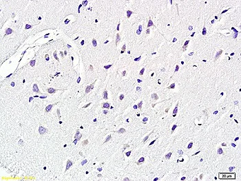 Immunohistochemistry (Formalin/PFA-fixed paraffin-embedded sections) - Anti-KCNN4 antibody (AB215990)