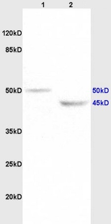 Western blot - Anti-KCNN4 antibody (AB215990)