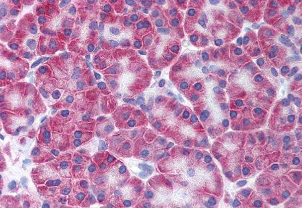 Immunohistochemistry (Formalin/PFA-fixed paraffin-embedded sections) - Anti-KCNN4 antibody - N-terminal (AB219108)