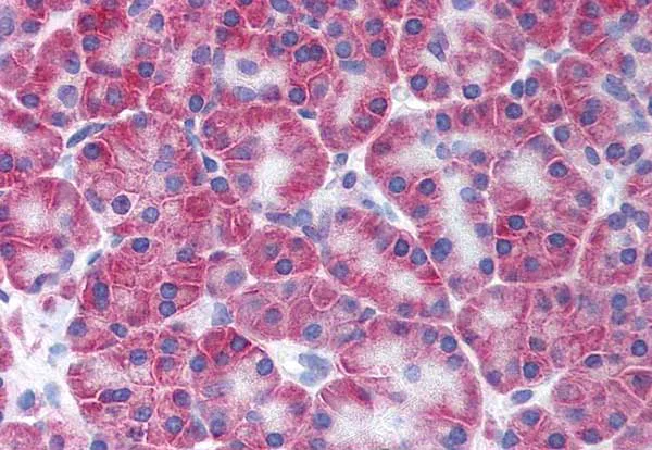 Immunohistochemistry (Formalin/PFA-fixed paraffin-embedded sections) - Anti-KCNN4 antibody - N-terminal (AB219108)