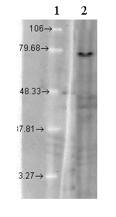 Western blot - Anti-KCNQ1 antibody [N37A/10] (AB84819)