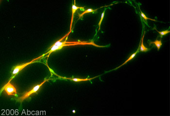 Immunocytochemistry/ Immunofluorescence - Anti-KCNQ2 antibody (AB22897)