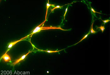 Immunocytochemistry/ Immunofluorescence - Anti-KCNQ2 antibody (AB22897)
