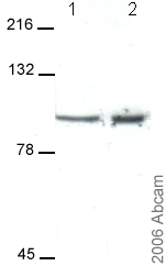 Western blot - Anti-KCNQ2 antibody (AB22897)