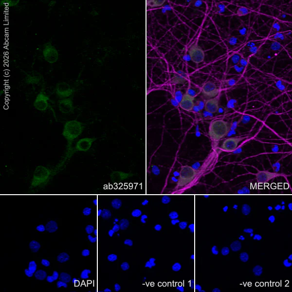 Immunocytochemistry/ Immunofluorescence - Anti-KCNQ2 antibody [EPR29531-83] (AB325971)