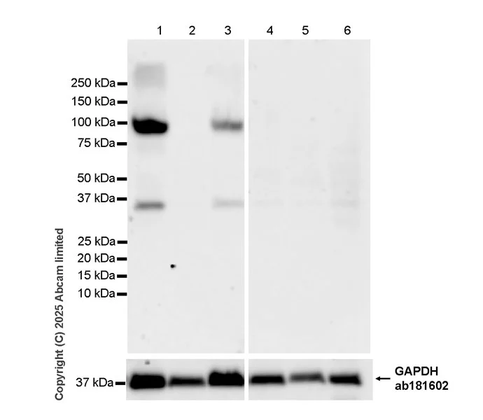 Western blot - Anti-KCNQ3 antibody [EPR25237-111] (AB325554)