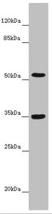 Western blot - Anti-KCNS3 antibody (AB230343)