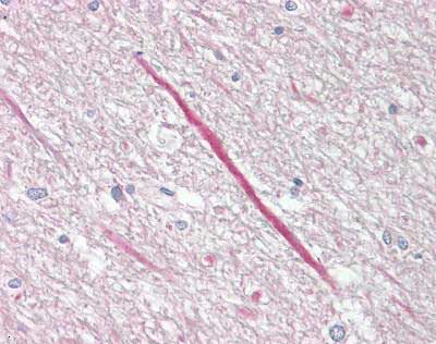 Immunohistochemistry (Formalin/PFA-fixed paraffin-embedded sections) - Anti-KCNT1/SLACK antibody (AB167027), expandable thumbnail
