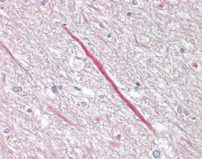 Immunohistochemistry (Formalin/PFA-fixed paraffin-embedded sections) - Anti-KCNT1/SLACK antibody (AB167027)