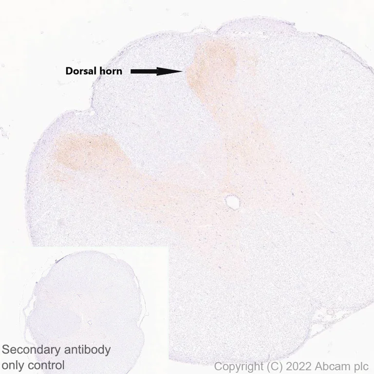 Immunohistochemistry (Formalin/PFA-fixed paraffin-embedded sections) - Anti-KCNT1/SLACK antibody [EPR24145-225] (AB305039)