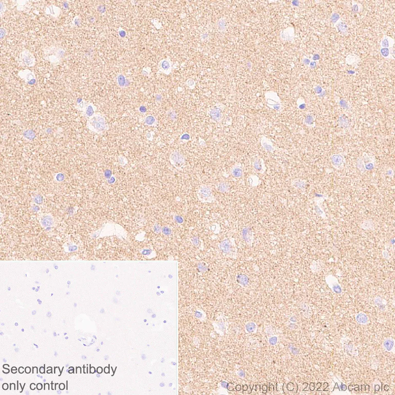 Immunohistochemistry (Formalin/PFA-fixed paraffin-embedded sections) - Anti-KCNT1/SLACK antibody [EPR24145-225] - BSA and Azide free (AB305040)