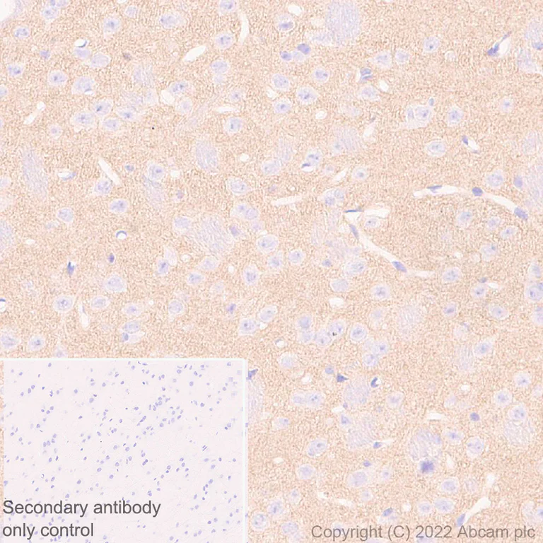 Immunohistochemistry (Formalin/PFA-fixed paraffin-embedded sections) - Anti-KCNT1/SLACK antibody [EPR24145-225] - BSA and Azide free (AB305040)