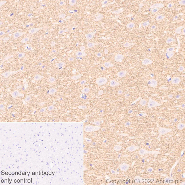 Immunohistochemistry (Formalin/PFA-fixed paraffin-embedded sections) - Anti-KCNT1/SLACK antibody [EPR24145-225] - BSA and Azide free (AB305040)