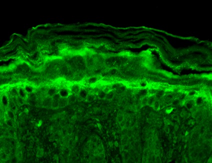 Immunohistochemistry (Formalin/PFA-fixed paraffin-embedded sections) - Anti-KCNT1/SLACK antibody [N3/26] (AB94578), expandable thumbnail