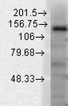 Western blot - Anti-KCNT1/SLACK antibody [N3/26] (AB94578), expandable thumbnail