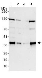 Western blot - Anti-KCTD12 antibody (AB124260)