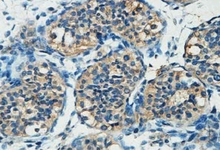 Immunohistochemistry (Formalin/PFA-fixed paraffin-embedded sections) - Anti-KCTD17 antibody (AB124349)