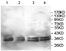 Western blot - Anti-KCTD17 antibody (AB124349)
